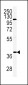 ADIPOR2 Antibody (Center)